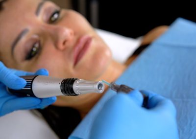 Medical Microneedling Pen 1NEED PRO